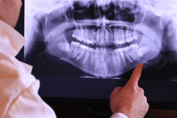 Best Urgent Dental Care for Toothache in Roan Mountain, TN